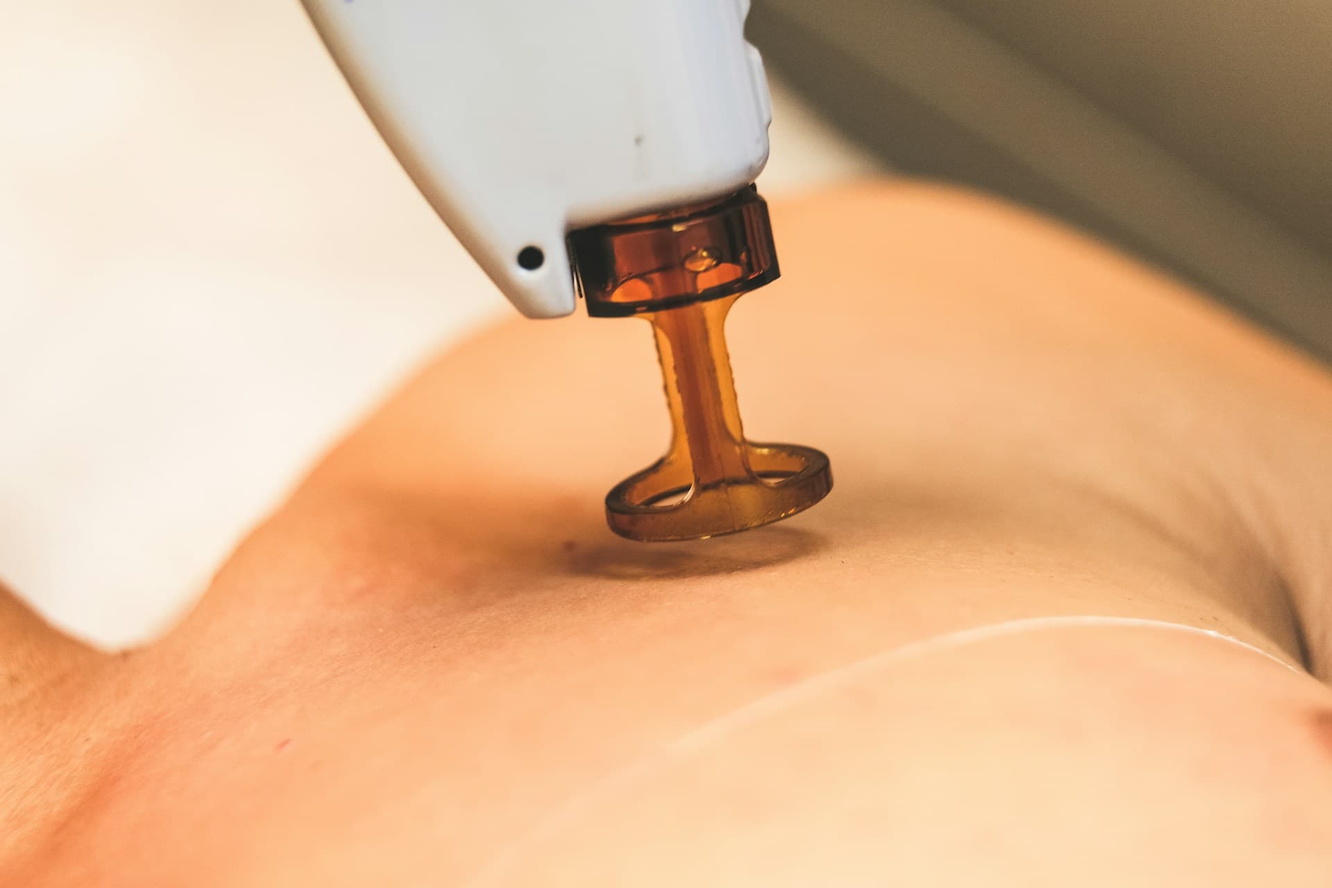 Fractional CO₂ laser handpiece applied to skin during resurfacing treatment